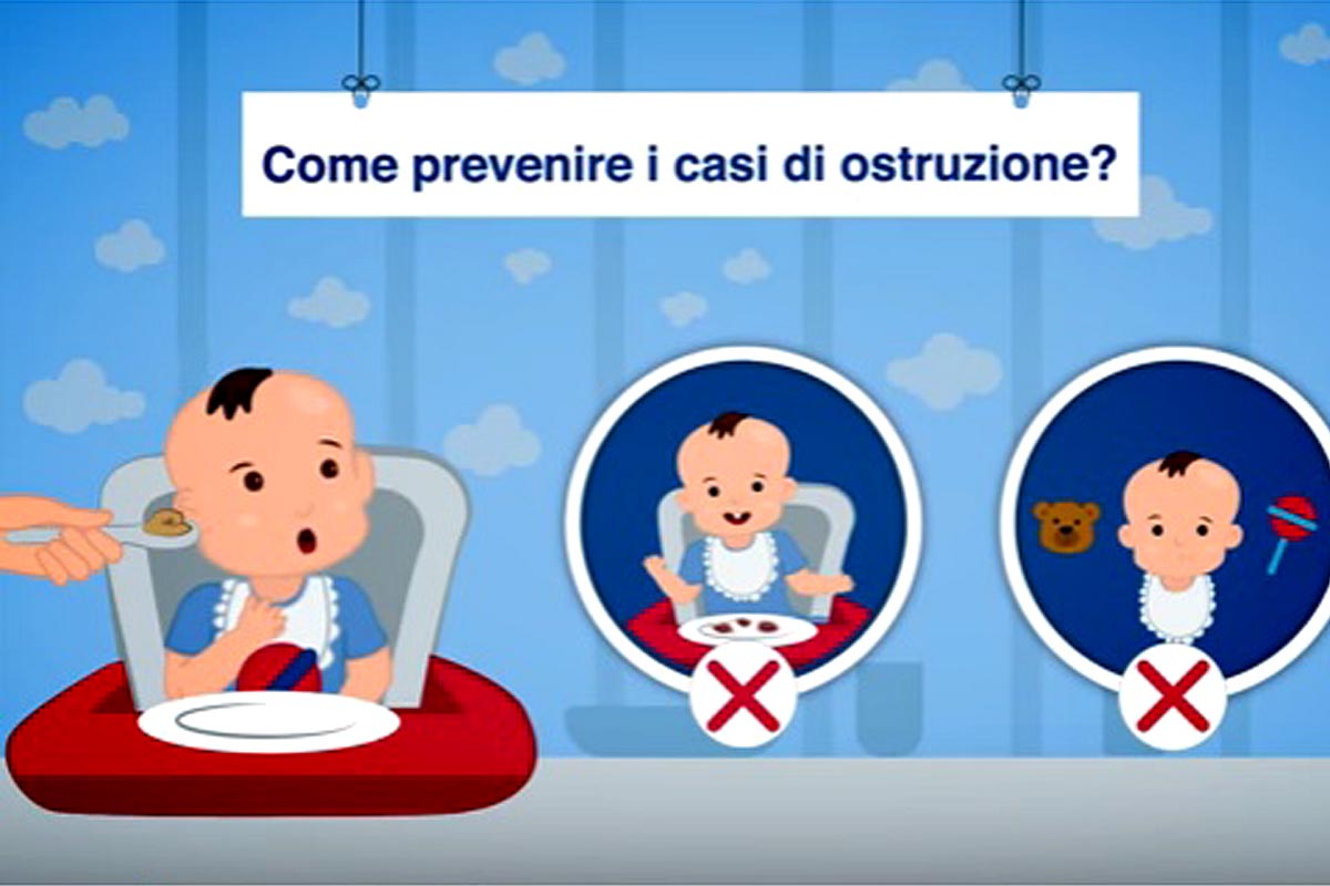 come prevenire ostruzione pediatrica