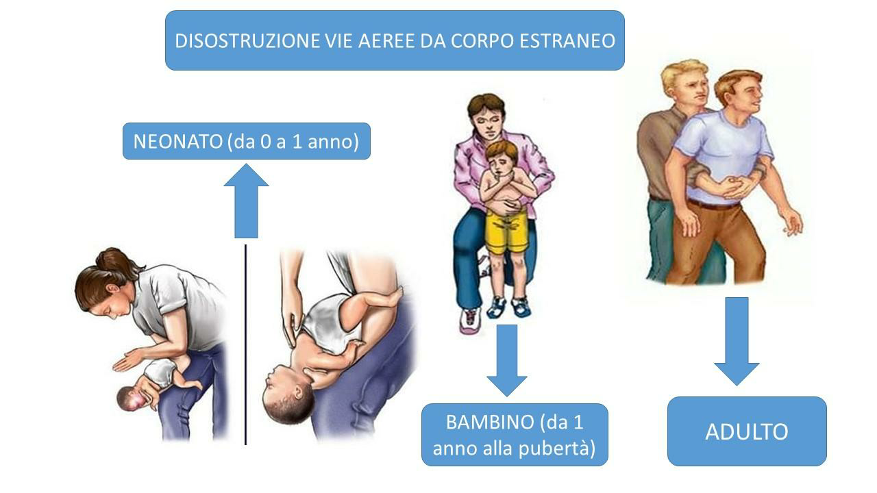 disostruzione adulti